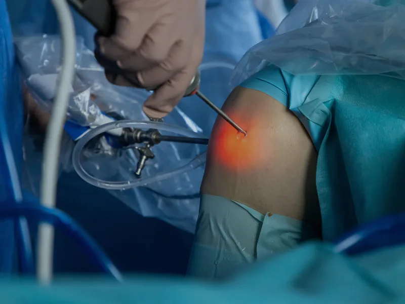 Arthroscopic keyhole knee and shoulder surgery at Mahika Hospital, Guntur